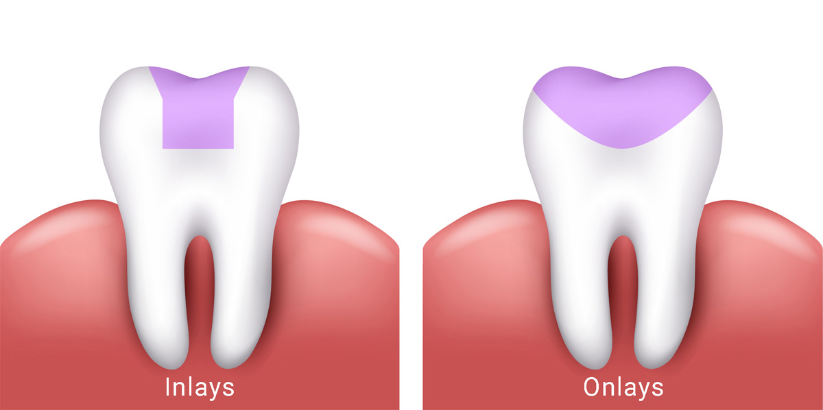 Orthodontist in Raysan Gandhinagar