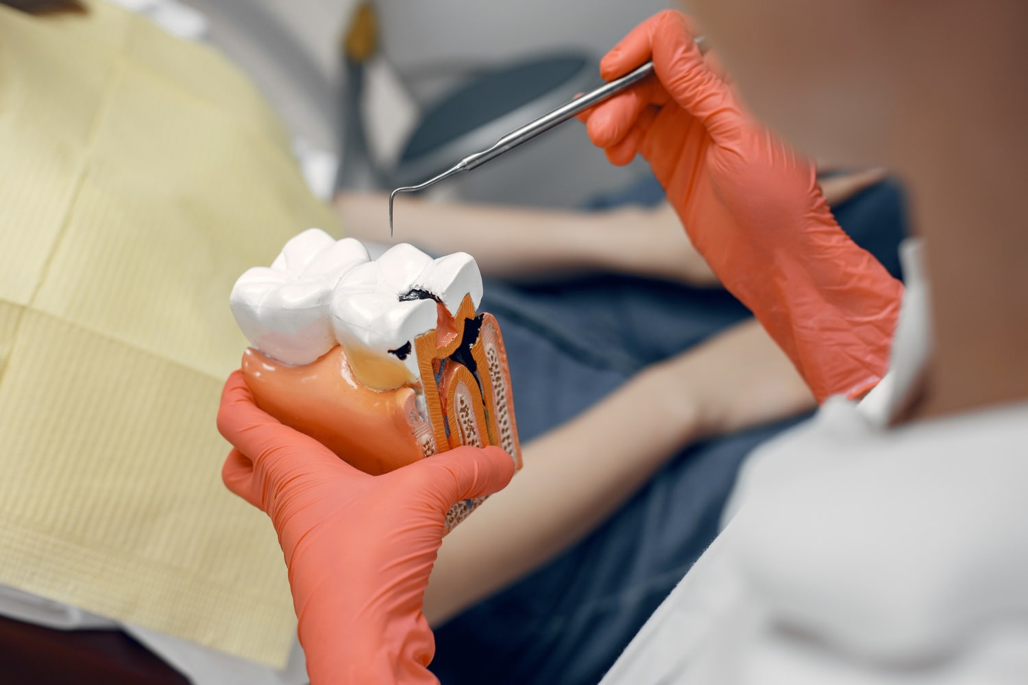 Dental Bridge Treatment in Gandhinagar